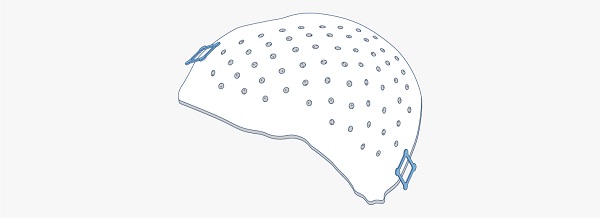Craniomaxillofacial plates