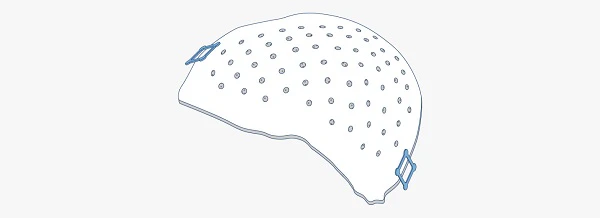 Craniomaxillofacial plates