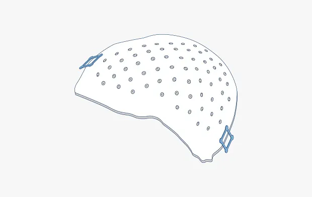 Craniomaxillofacial plates