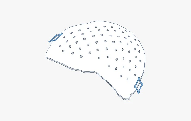 Craniomaxillofacial plates