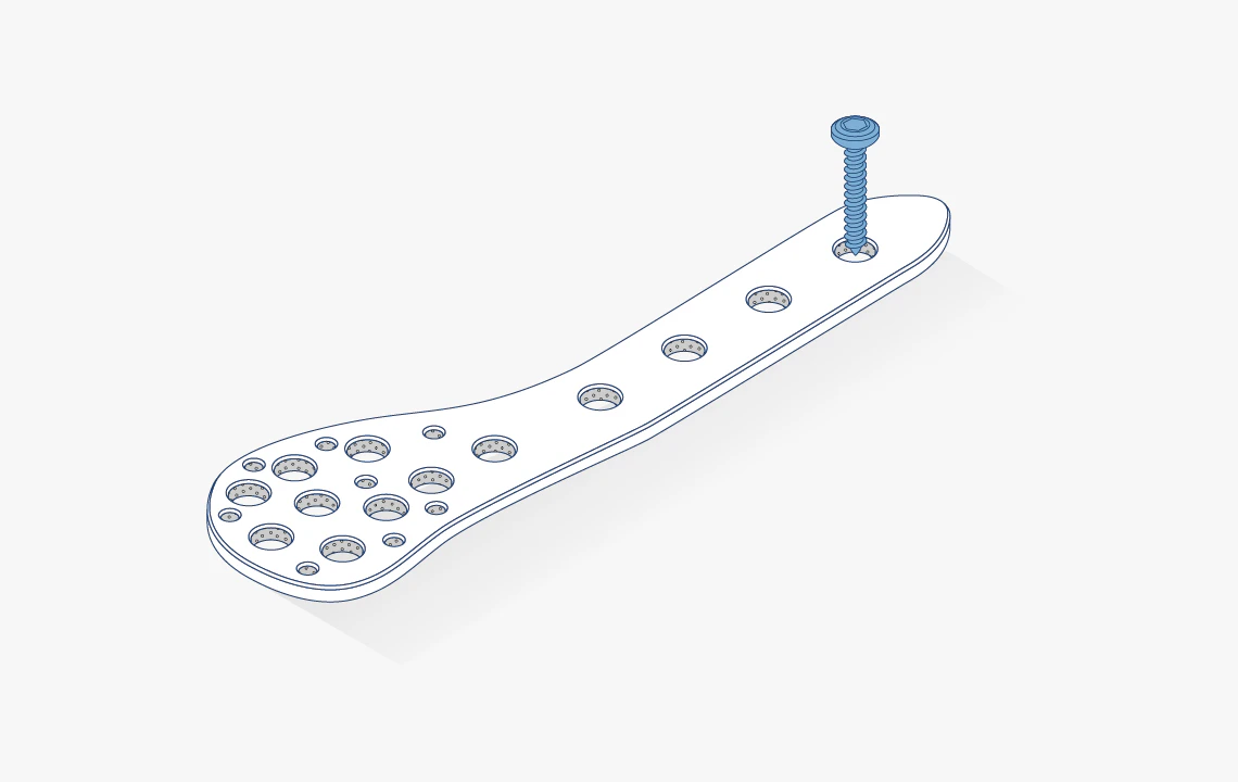 Device Illustrations Fracture fixation plates