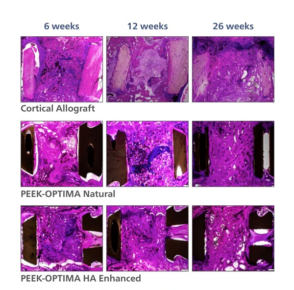 POHAE Histological Comparison