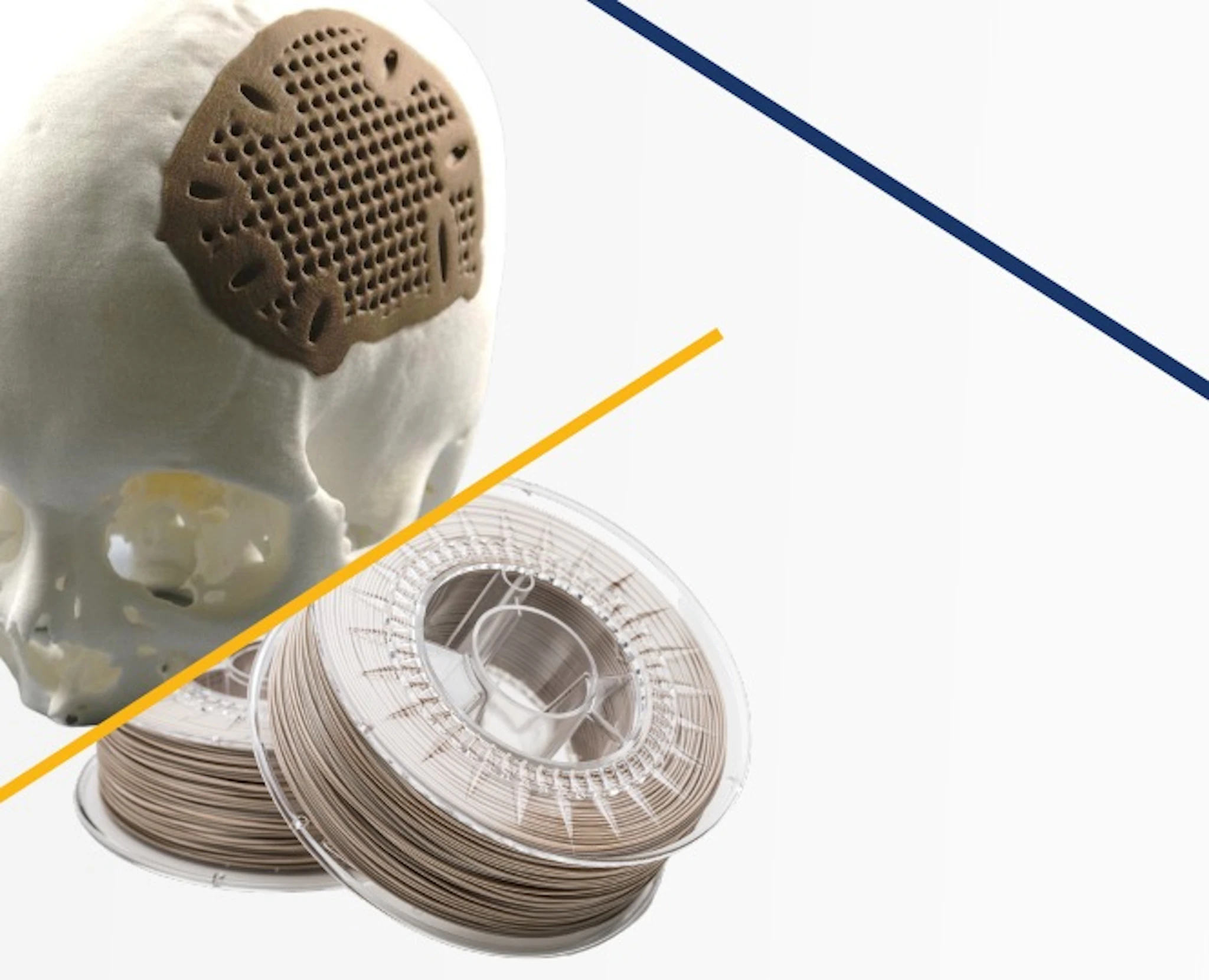 Invibio launches implantable PEEK filament for 3D printing