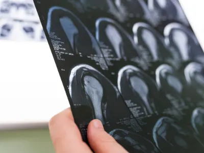 Scan of a patient's shoulder 