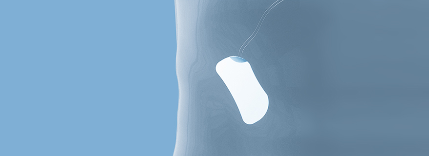 PEEK-OPTIMA drug delivery implantable devices 