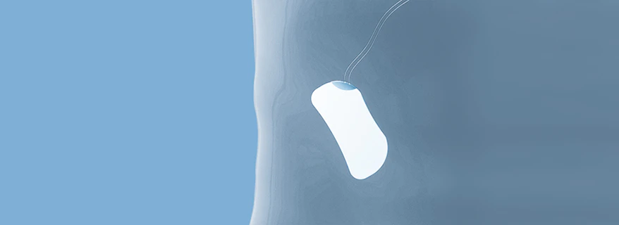 PEEK-OPTIMA drug delivery implantable devices