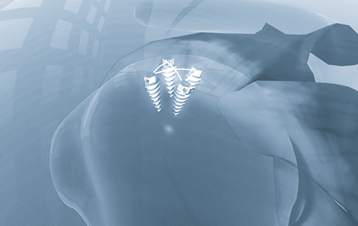 Orthopaedic solutions 