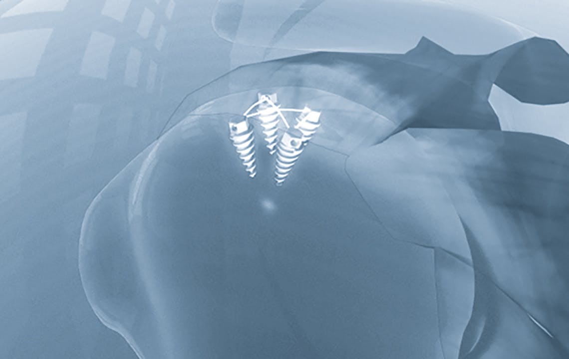 Orthopaedic solutions 