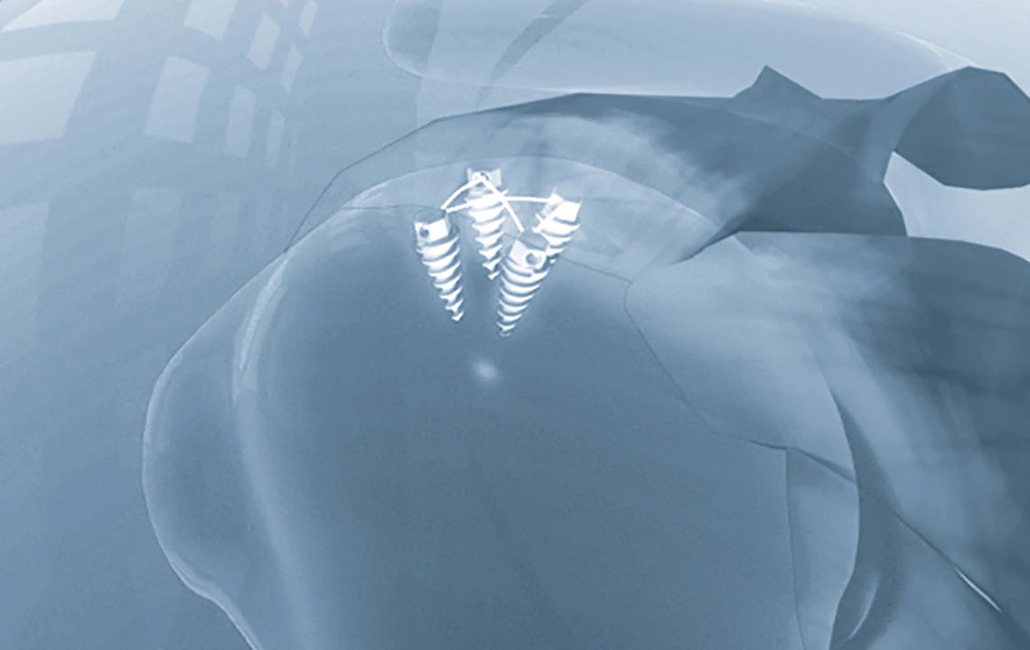 Orthopaedic solutions