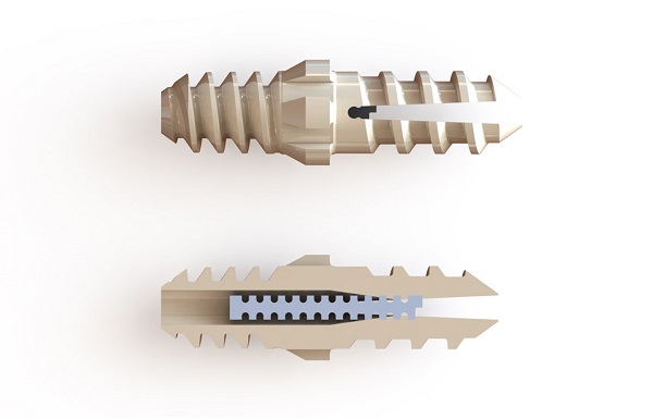 US FDA clears first foot and ankle implant made from PEEK