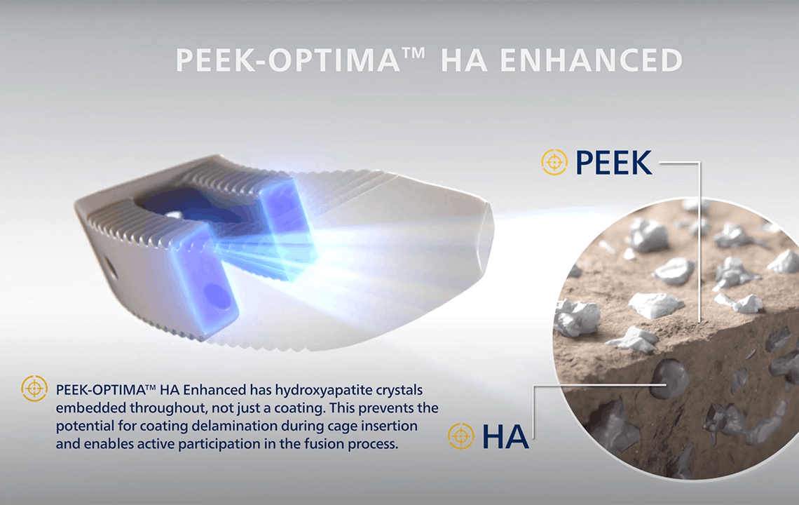 PEEK-Optima_HA_Enhanced