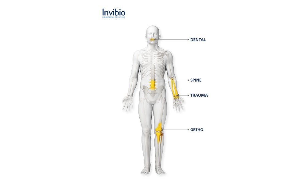Invibio´s PEEK-OPTIMA™ polymers are used in ~9 million implanted devices worldwide (c) Invibio Biomaterial Solutions